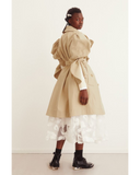 Puff-sleeved Trenchcoat